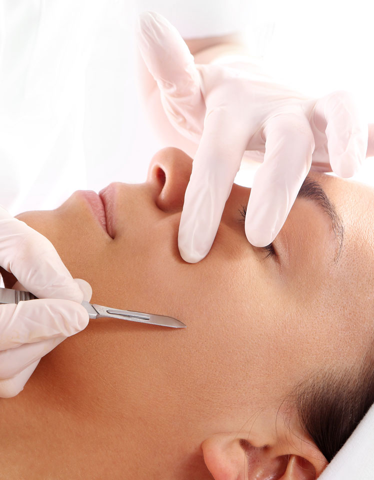 Dermaplaning